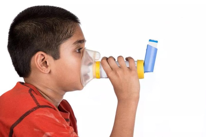 asthma asma vocal cord bronchitis cough dysfunction alergi symptoms mengenal penyebab plexus garganta flemas causes medicalnewstoday pengobatannya lamps shortness mucosidad asthma asma vocal cord bronchitis cough dysfunction alergi symptoms mengenal penyebab plexus garganta flemas causes medicalnewstoday pengobatannya lamps shortness mucosidad