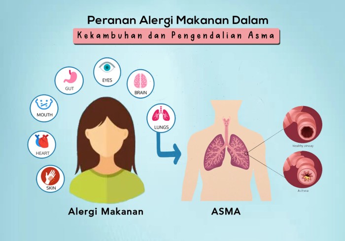 asma alergi kekambuhan peranan pengendalian pada patut diwaspadai Pengelolaan asma dan alergi terbaru