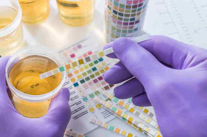 Pemeriksaan laboratorium dan interpretasinya terbaru